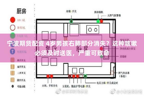 宁波期货配资 4岁男孩右肺部分消失？这种咳嗽必须及时送医，严重可致命